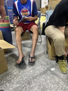 【花蓮堰塞湖水災】物資站現場訪查 壓力襪獲得正面回饋 1 結痂的傷口是奮力整理災後家園的印記,感染風險不容忽視